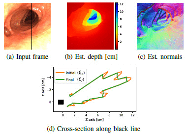 Teaser for Photometric single-view dense 3D reconstruction in endoscopy