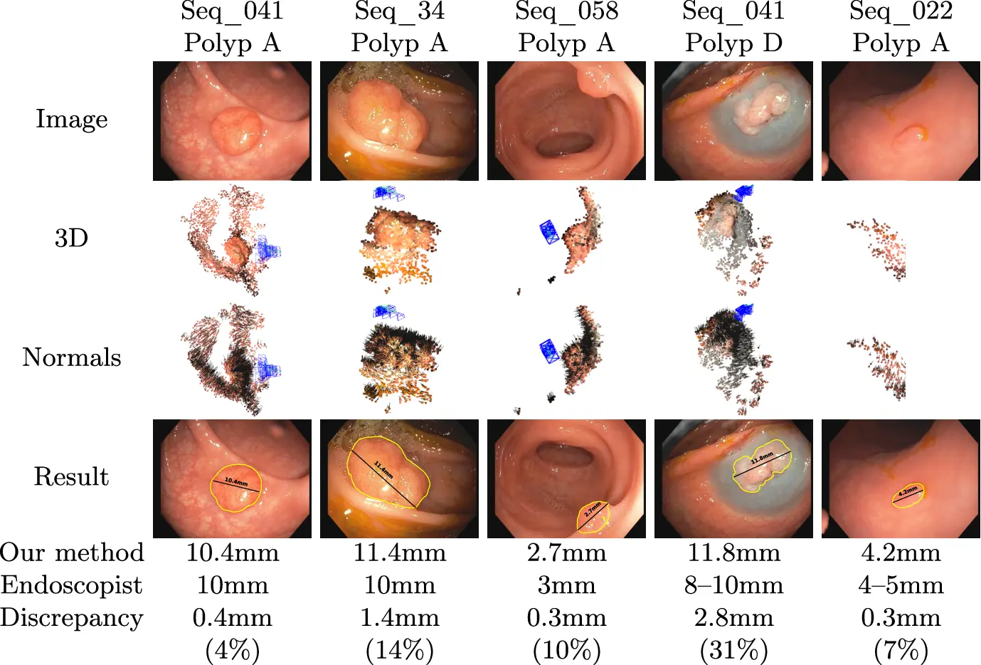 Results in EndoMapper dataset